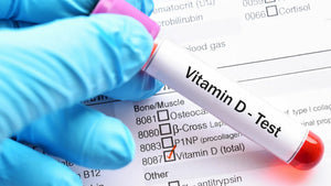 Research Confirms Optimum Vitamin D Blood Values