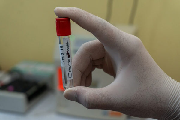African Americans with Low Vitamin D Status Have Increased Covid-19 Risk